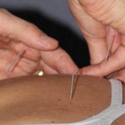 img-clinic-acu-inner